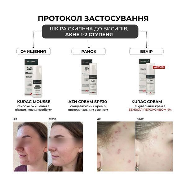 Kurac cream Braderm &mdash; крем з бензоїл пероксидом 4% для проблемної шкіри 30 мл BRADERM-KURAC-CREAM-30 фото