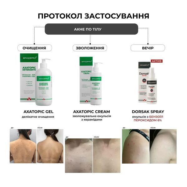 Dorsak spray Braderm &mdash; спрей з бензоїл пероксидом 6% для тіла 100 мл BRADERM-DORSAK-SPRAY-100 фото