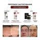 Tramexal cream Braderm &mdash; освітлювальна емульсія для шкіри 30 мл BRADERM-TRAMEXAL-30 фото 2