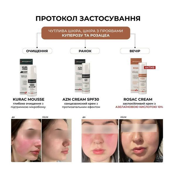 Rosac cream Braderm &mdash; крем з азелаїновою кислотою 10% 30 мл BRADERM-ROSAC-30 фото