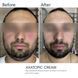 Axatopic cream Braderm &mdash; емульсія для тіла з керамідами 250 мл BRADERM-AXATOPIC-CREAM-250 фото 2